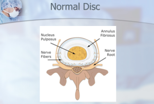 Dr Luis Lombardi-Normal Disc