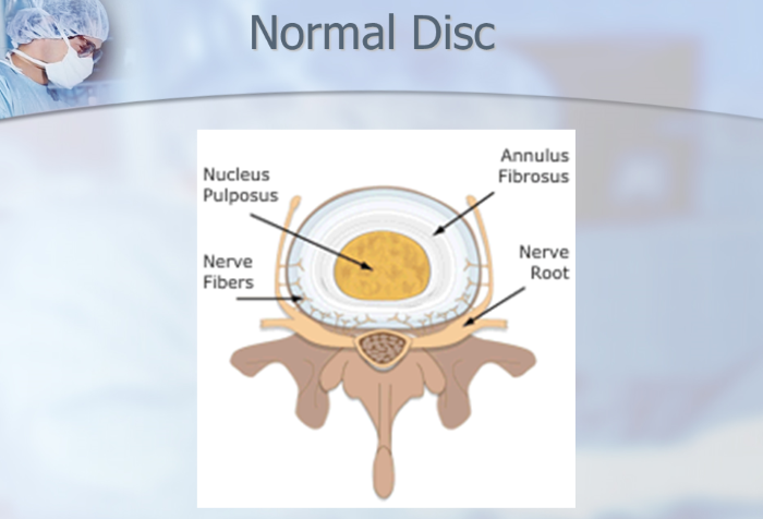 Anatomy of the Vertebra and Intervertebral Disc by Dr. Luis Lombardi