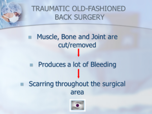 Dr. Luis Lombardi-Traumatic Back Surgery