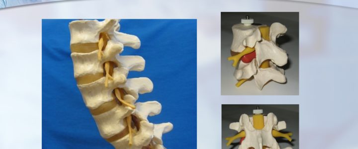 Anatomy of the Vertebra and Disc by Dr. Luis Lombardi