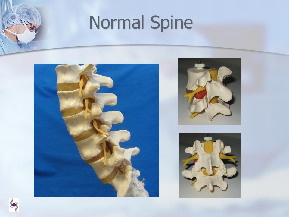 Anatomy of the Vertebra and Disc by Dr. Luis Lombardi