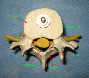 Dr. Luis Lombardi-Spinal Canal