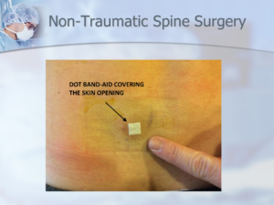 Dr. Luis Lombardi-Non-Traumatic Spine Surgery